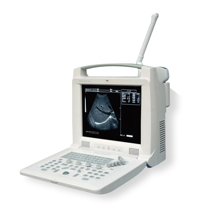 Full Digital Portable Ultrasound Scanner
