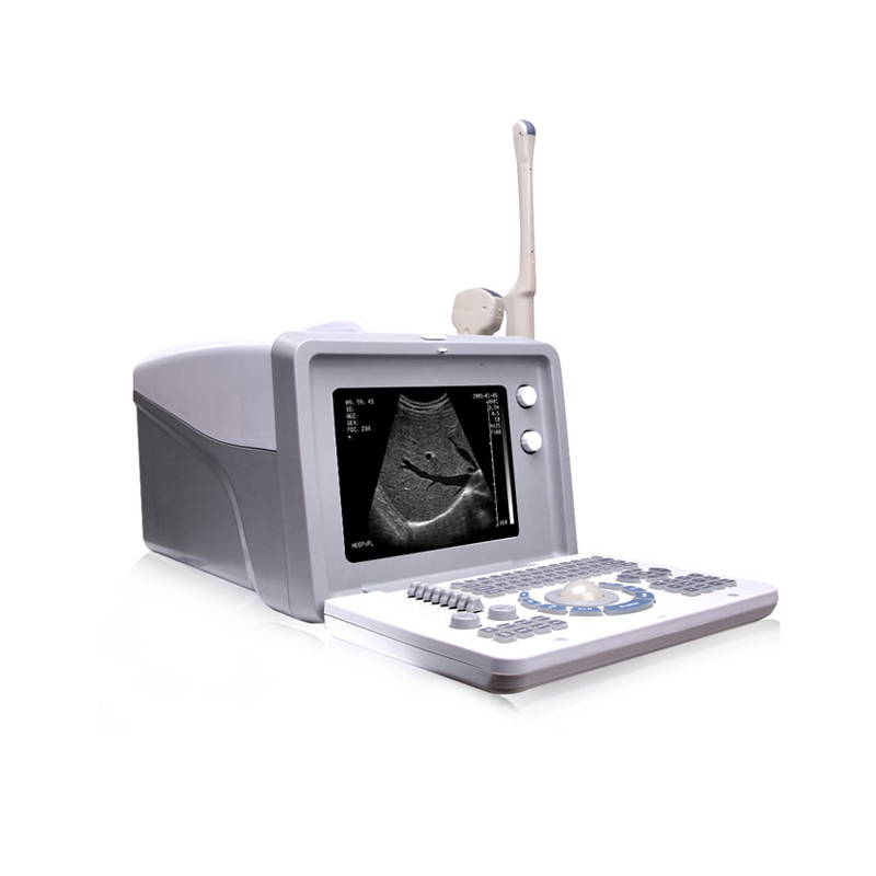 Digital Portable Ultrasound Scanner