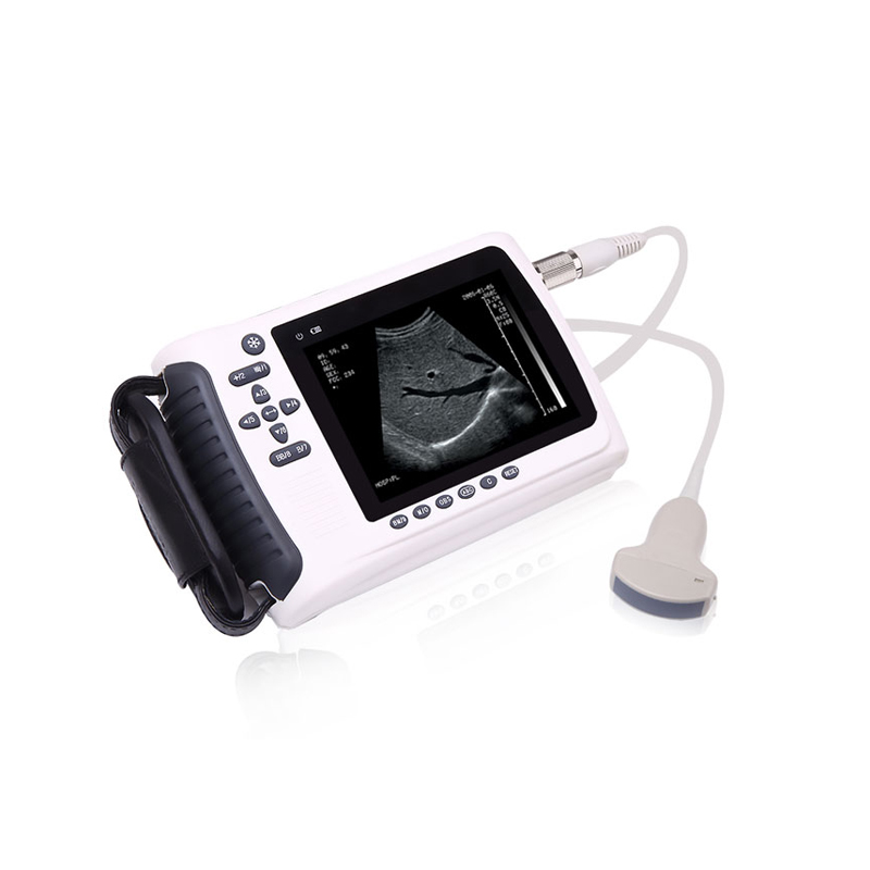 Handheld Ultrasound Scanner
