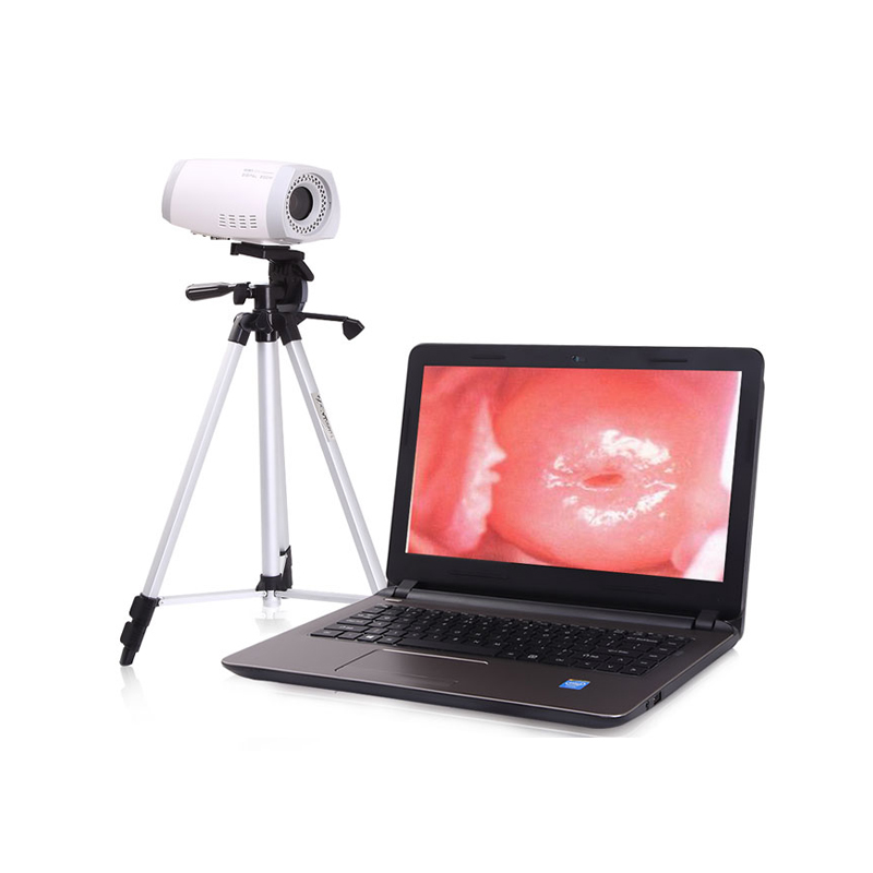 Portable Colposcope