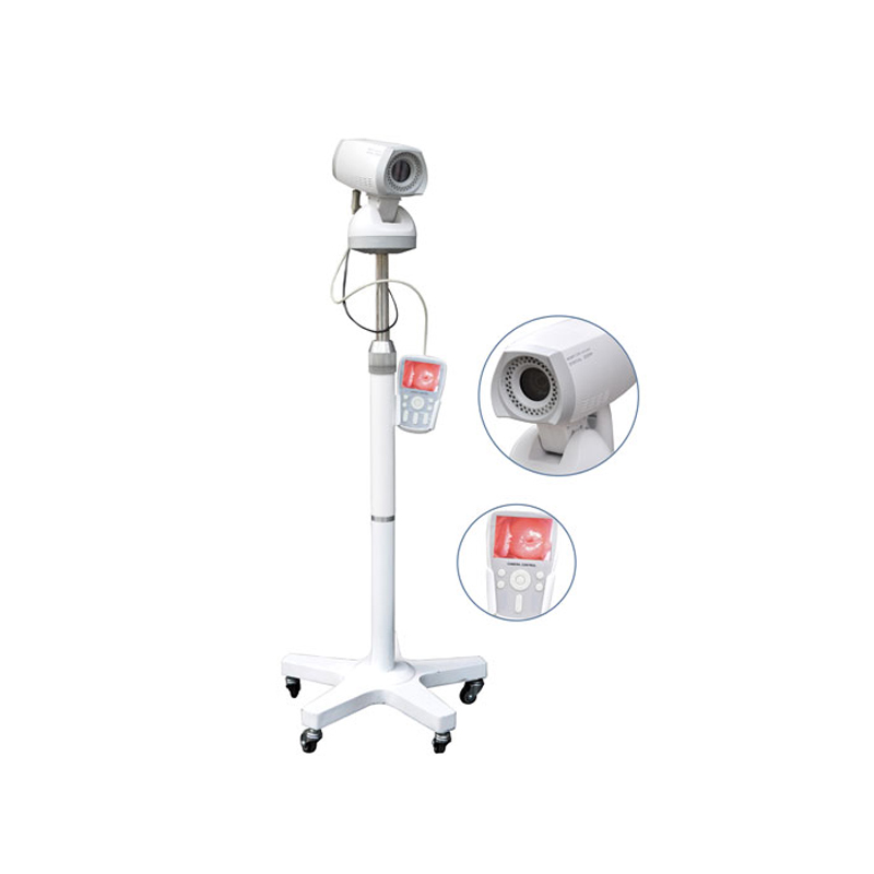 Video Colposcope