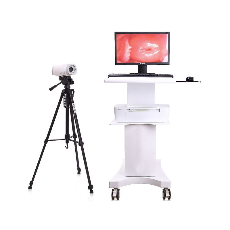 Trolley Video Colposcope